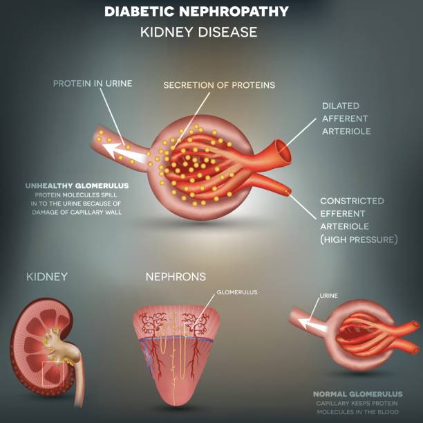 Best Doctor For Diabetic kidney Disease in Andheri
